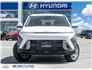 2026 Hyundai Kona 2.0L Essential (Stk: 471372) in Milton - Image 2 of 22