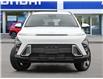 2026 Hyundai Kona 2.0L Preferred (Stk: 2610360) in Aurora - Image 2 of 23