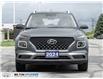 2024 Hyundai Venue Ultimate w/Black Interior (IVT) (Stk: 296082) in Milton - Image 2 of 24
