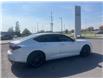 2024 Acura TLX A-Spec (Stk: 25P132) in Kingston - Image 9 of 20