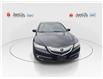 2015 Acura TLX Elite (Stk: 802014) in Ottawa - Image 3 of 25 2015 Acura TLX Elite (Stk: 802014) in Ottawa - Image 3 of 25