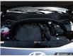 2026 Hyundai Palisade Ultimate Calligraphy (Stk: U26P57A) in London - Image 8 of 27
