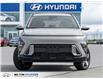 2026 Hyundai Kona 2.0L Preferred (Stk: 463313) in Milton - Image 2 of 24