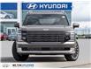 2026 Hyundai Palisade Ultimate Calligraphy (Stk: 129572) in Milton - Image 2 of 37