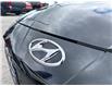 2023 Hyundai Elantra HEV Luxury (Stk: P2273A) in Newmarket - Image 4 of 27