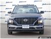2020 Hyundai Venue Preferred (Stk: 43260) in Georgetown - Image 8 of 30