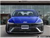2025 Hyundai Elantra N Line Ultimate (Stk: U25E73A) in London - Image 2 of 27