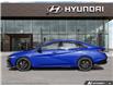 2025 Hyundai Elantra N Line Ultimate (Stk: U25E73A) in London - Image 3 of 27