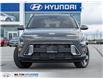 2026 Hyundai Kona 2.0L Preferred (Stk: 477740) in Milton - Image 2 of 22 2026 Hyundai Kona 2.0L Preferred (Stk: 477740) in Milton - Image 2 of 22