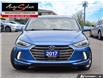 2017 Hyundai Elantra Limited (Stk: 1TBE187) in Scarborough - Image 2 of 28