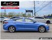 2017 Hyundai Elantra Limited (Stk: 1TBE187) in Scarborough - Image 3 of 28