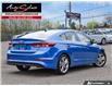 2017 Hyundai Elantra Limited (Stk: 1TBE187) in Scarborough - Image 4 of 28