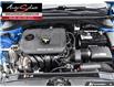 2017 Hyundai Elantra Limited (Stk: 1TBE187) in Scarborough - Image 8 of 28