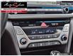 2017 Hyundai Elantra Limited (Stk: 1TBE187) in Scarborough - Image 26 of 28