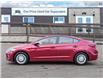 2017 Hyundai Elantra Limited (Stk: 11754) in Milton - Image 3 of 30