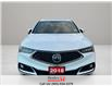 2018 Acura TLX Elite A-Spec (Stk: R12553) in St. Catharines - Image 3 of 12