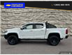 2018 Chevrolet Colorado ZR2 (Stk: 25016C) in Quesnel - Image 3 of 25