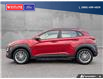 2020 Hyundai Kona 2.0L Preferred (Stk: 25T160A) in Williams Lake - Image 3 of 29