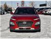 2020 Hyundai Kona 2.0L Luxury (Stk: PP1898) in Saskatoon - Image 8 of 26