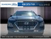 2021 Hyundai Kona 1.6T Ultimate (Stk: P3929A) in Kamloops - Image 2 of 25