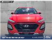 2020 Hyundai Kona 2.0L Luxury (Stk: PT028AA) in Kamloops - Image 2 of 25