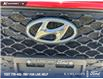 2020 Hyundai Kona 2.0L Luxury (Stk: PT028AA) in Kamloops - Image 9 of 25