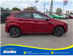 2022 Hyundai Kona 1.6T N Line w/Ultimate Package (Stk: B1805A) in Sarnia - Image 4 of 29