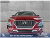 2020 Hyundai Kona 1.6T Trend w/Two-Tone Roof (Stk: P13891) in Airdrie - Image 2 of 25