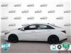 2022 Hyundai Elantra Preferred (Stk: A250360) in Hamilton - Image 3 of 23