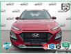 2020 Hyundai Kona 2.0L Luxury (Stk: R532A) in Grimsby - Image 2 of 24