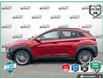2020 Hyundai Kona 2.0L Luxury (Stk: R532A) in Grimsby - Image 3 of 24
