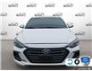 2018 Hyundai Elantra Sport (Stk: B250363Z) in Hamilton - Image 2 of 23