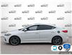 2018 Hyundai Elantra Sport (Stk: B250363Z) in Hamilton - Image 3 of 23
