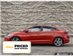 2017 Hyundai Elantra  (Stk: S4021A) in Hamilton - Image 3 of 28