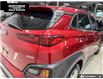 2018 Hyundai Kona 2.0L Essential (Stk: V25552A) in Sault Ste. Marie - Image 12 of 12