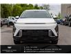 2024 Hyundai Kona 2.0L Essential (Stk: 25099A) in Ottawa - Image 4 of 24