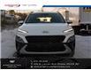 2023 Hyundai Kona 2.0L Preferred Sun & Leather Package (Stk: 25258A) in Ottawa - Image 6 of 23