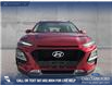 2018 Hyundai Kona 2.0L Preferred (Stk: P1593) in Canmore - Image 2 of 27
