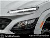 2022 Hyundai Kona 1.6T N Line (Stk: RP229A) in Milton - Image 3 of 25 2022 Hyundai Kona 1.6T N Line (Stk: RP229A) in Milton - Image 3 of 25
