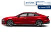 2025 Hyundai Sonata N-Line Ultimate (Stk: 1000176712TRANSIT) in Chatham - Image 2 of 12