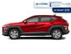 2025 Hyundai Kona 2.0L Essential (Stk: 1000177621TRANSIT) in Chatham - Image 2 of 12