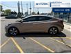 2015 Hyundai Elantra Limited (Stk: S169A) in Chatham - Image 2 of 23
