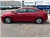 2019 Hyundai Elantra Preferred (Stk: 5B036A) in Chatham - Image 2 of 20