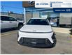 2026 Hyundai Kona 2.0L Essential (Stk: T033) in Chatham - Image 3 of 26