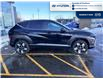 2026 Hyundai Kona 2.0L Preferred w/Trend Package (Stk: T104) in Chatham - Image 4 of 24
