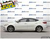 2018 Hyundai Elantra GL (Stk: 83866) in London - Image 3 of 25