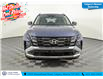 2025 Hyundai Tucson Preferred (Stk: TU0086) in Calgary - Image 4 of 24