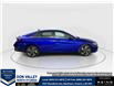 2026 Hyundai Elantra Luxury w/Two-Tone Interior (Stk: 16105111) in Markham - Image 8 of 20 2026 Hyundai Elantra Luxury w/Two-Tone Interior (Stk: 16105111) in Markham - Image 8 of 20