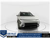 2026 Hyundai Kona 2.0L Preferred (Stk: 16105254) in Markham - Image 2 of 16