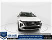 2026 Hyundai Tucson Preferred (Stk: 16105325) in Markham - Image 2 of 20